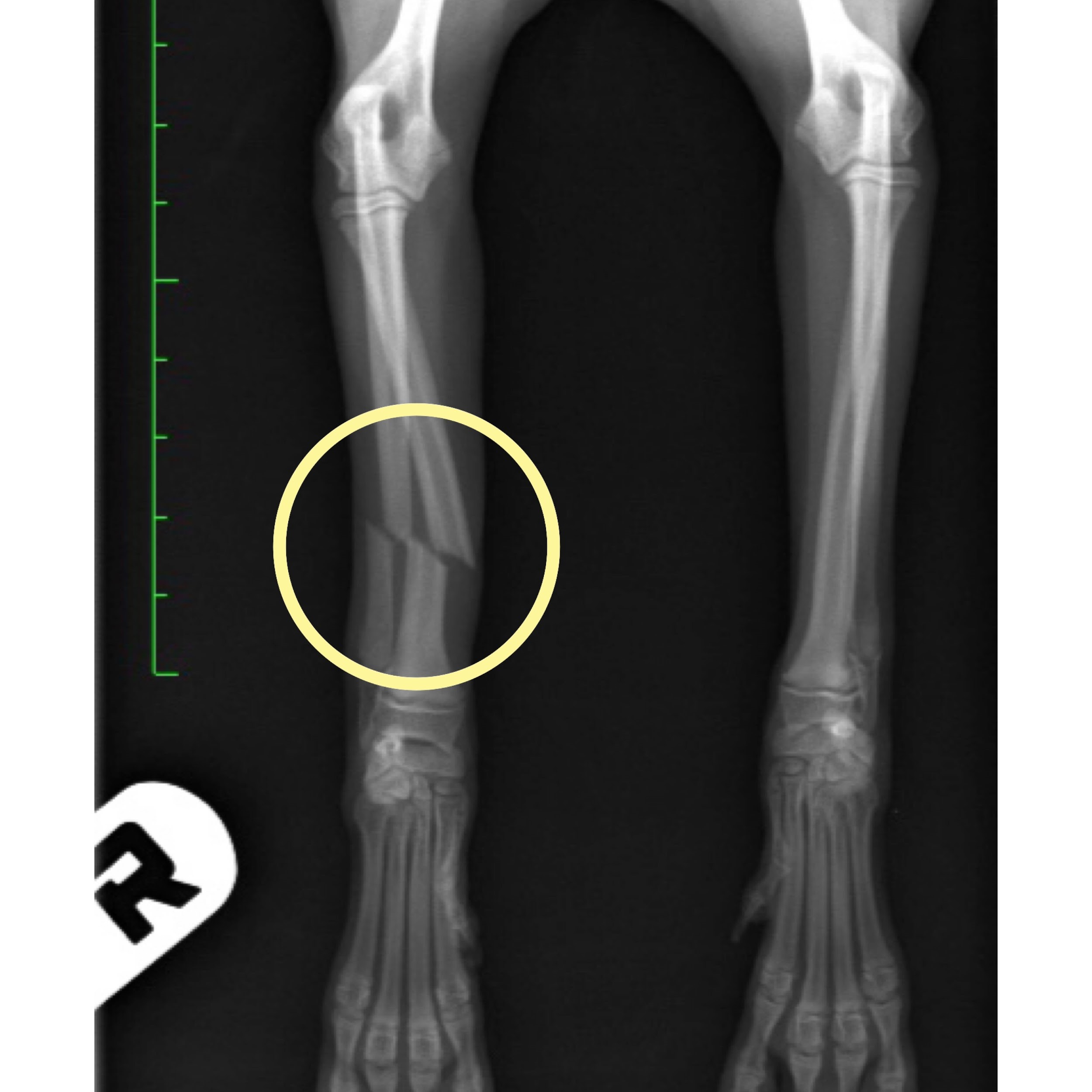 症例報告 橈尺骨骨折 手の骨折 シリウス犬猫病院